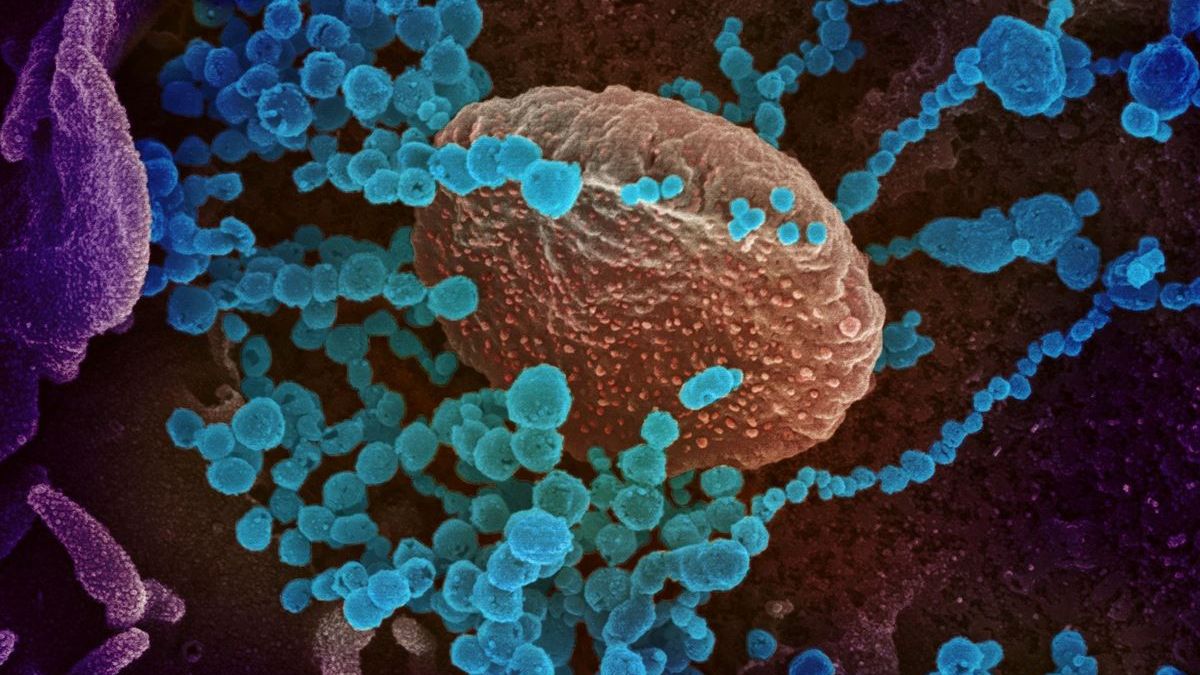 Jak koronavirus uniká lidské imunitě? Postaví si v těle „superbuňky“